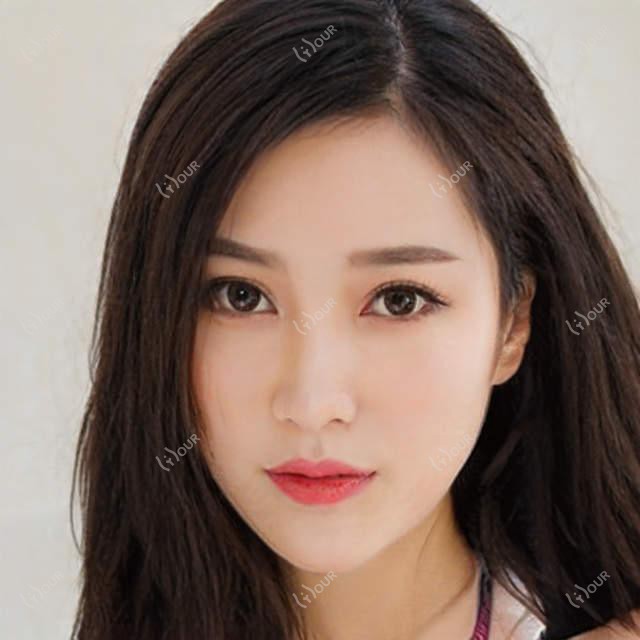 石家庄整形医生孟祥重吴小玉王兴奎,眼部鼻部美容抗衰老技术如何?