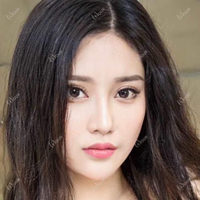 东莞地区精选双眼皮隆鼻医生排行，口碑好评医生名单参考