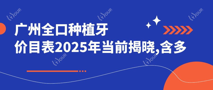 广州全口种植牙价目表2025年当前揭晓,含多颗种植牙/半口种植牙/全口种植牙费用明细