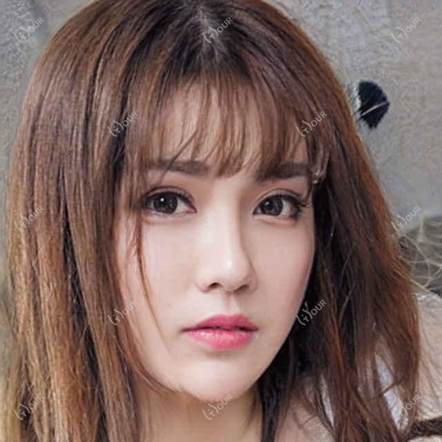 北京整好医美价格全览：双眼皮埋线2K+|眼综合6K+至热玛吉超声炮实惠
