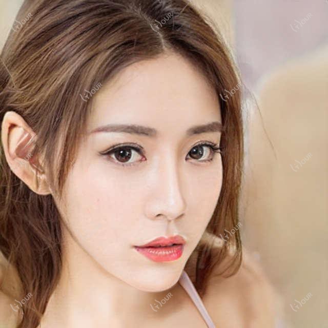 Inmode仪器价格揭秘 一台到底多少钱 排名靠前的信息汇总