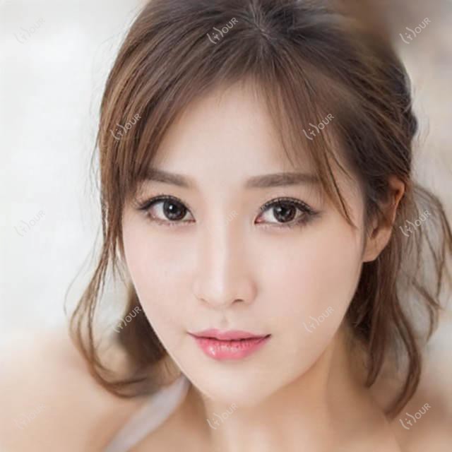 吉林中妍美容医院全项目价格揭秘：牙套矫正实惠|埋线提升性价比|种植牙2999+多面价格清单