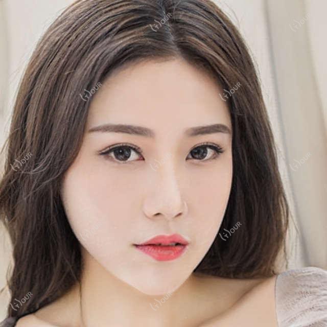 广州市军美整形抗衰老中心提费多少?隆鼻1W+ 祛皱2W+ 脂肪填充3W+