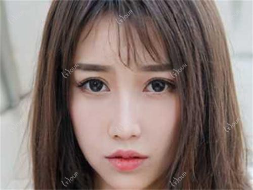 南充丰眉弓价格揭秘,医院推荐清单来啦!