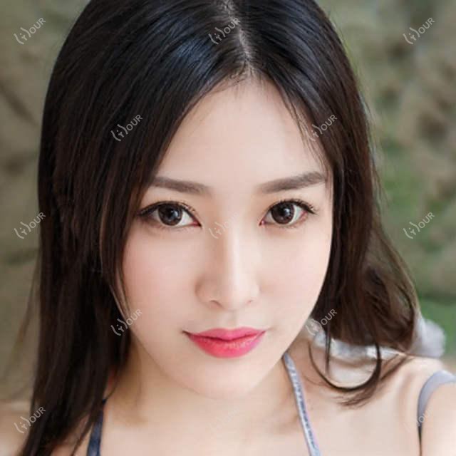 深圳光爱眼科全项目价格揭秘:近视激光&白内障手术性价比一览
