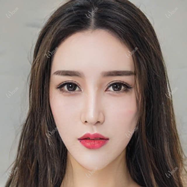 2025东莞鼻部手术多少钱?鼻部手术30000+/肋骨鼻综合6000+/耳软骨鼻部手术3000+