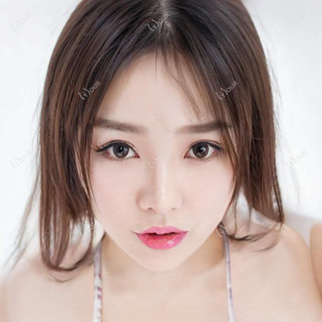 聊城眼周填充价格表大公开,医院推荐来啦!
