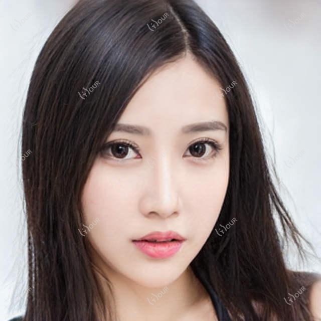 武汉凸嘴正颌手术价格表:武汉凸嘴正颌手术市场均价及各医院报价参考