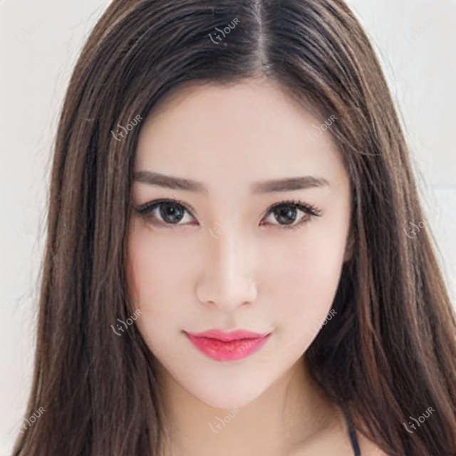 幼态脸项目适合年龄揭秘 多少钱做才划算 年龄与疗效排名分析