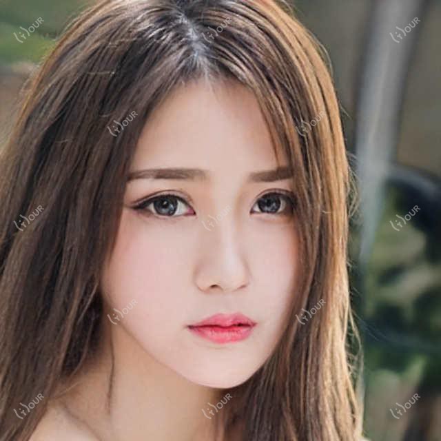 徐州InMode项目价格揭秘,这些医院性价比超高推荐!