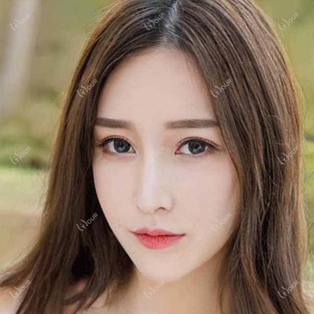 绍兴超皮秒Picoway与顺序揭秘?Picoway项目后多久适宜,价格亲民体验分享?