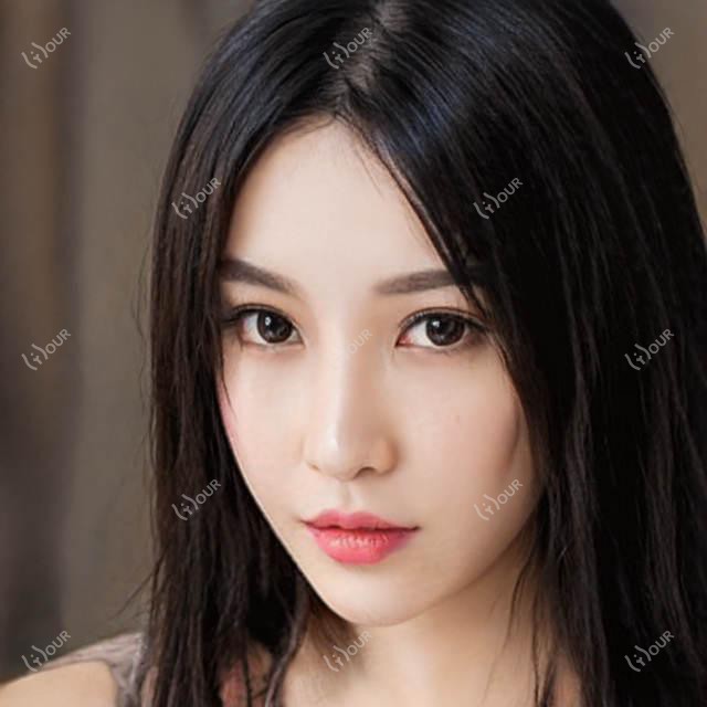 北京市华臣医美门诊费用揭秘？光子嫩肤5K+ 玻尿酸填充8K+ 热玛吉紧肤2W+