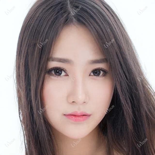 商丘牙齿矫正医生推荐：朱二明、祖梦蝶，精通成人及儿童正畸，含种植牙技术