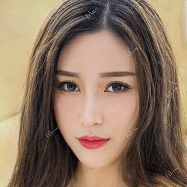 邢台口碑牙齿种植医生揭晓,张利何国华擅长瑞士ITI及微创种植技术