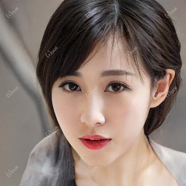 画缇丰眉弓项目价格揭秘 排名靠前疗效赞
