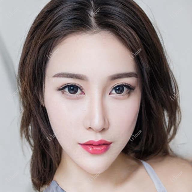 大理眼鼻抗衰名医推荐：韩冰, 孙际涛, 吴瑜以精细技艺受赞