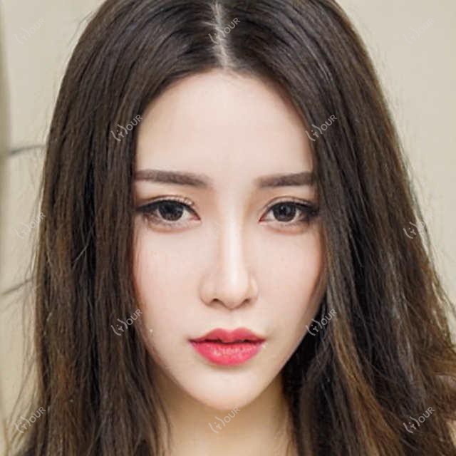 漳州仰德医美攻略：解锁热门 玻尿酸 整形价格清单