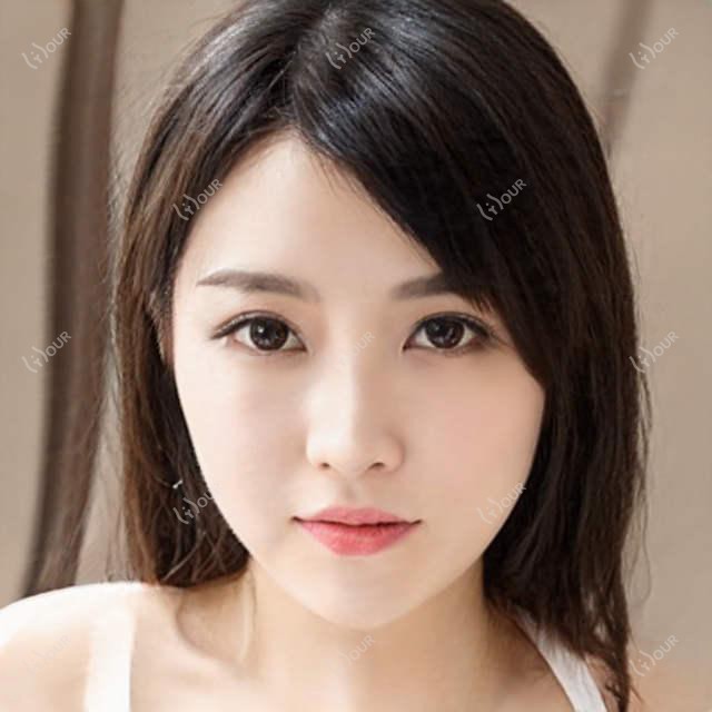 成都高新后美医美项目价目表:整形2W+ 皮肤管理5K-1W+ 微整8K起