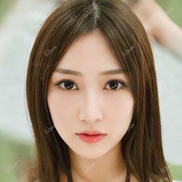 南京乳头内陷矫正价格明细2025新版,南京乳头内陷矫正/乳头内陷矫正多少钱