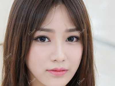 东莞美国皓齿美白排名及价格分享!价格也不贵的医院是那家呢?