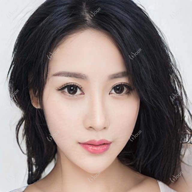 郑州Z大附二院正美医美价格揭秘:热门项目如玻尿酸费用一览