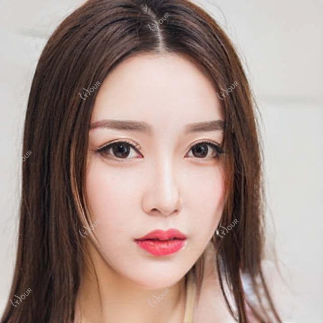 广州四环素牙美白价格多少钱？2025价目单：变色牙美白400元起、四环素牙美白400元起