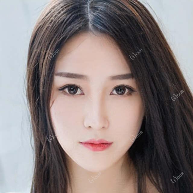 成都圣母医美项目价目表：整形手术8K起，皮肤管理3K元起，详细价格一览