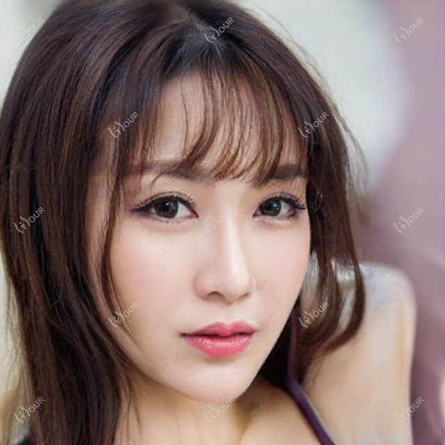 合肥单颗牙种植排行榜前10医院名单+价格价目单介绍!技术强医术精细