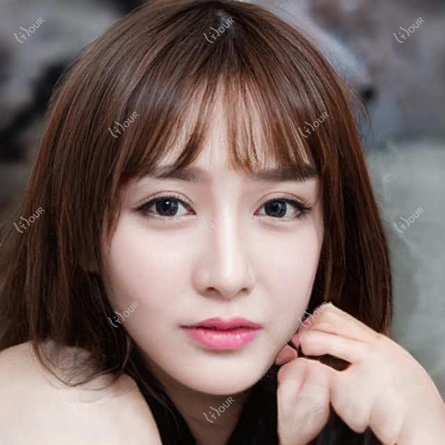 肇庆黑金超光子项目价格揭秘,医院推荐哪家强?