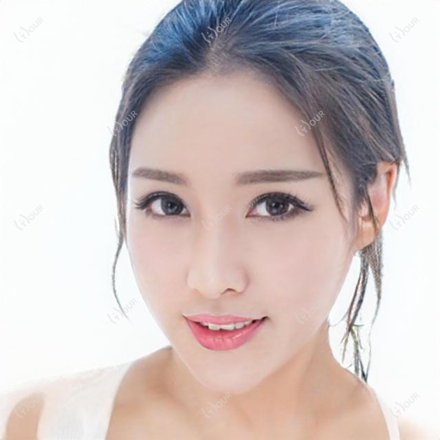 蚌埠嘟嘟唇价格揭秘，医院推荐来啦！