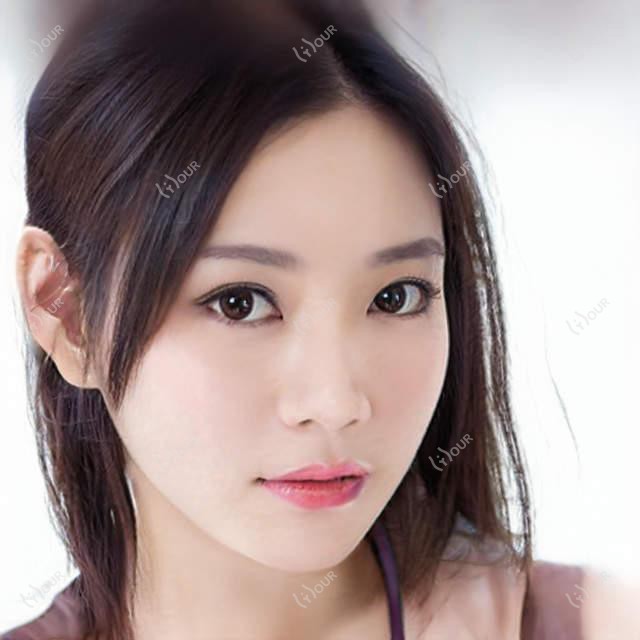 肇庆地区眼部整形名医推荐！双眼皮术后惊艳，口碑较佳，医生详情一览！