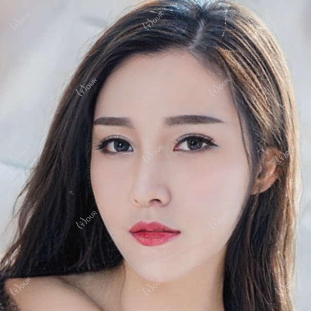 宁德福鼎优博仕口腔植牙价格揭秘?烤瓷牙5K+ 全瓷牙8K+ 牙齿矫正1W+