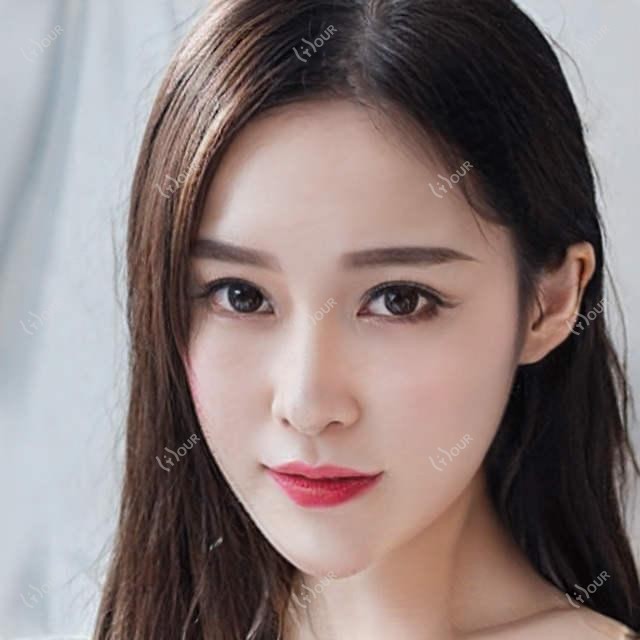 廊坊擅长白内障及ICL晶体植入医生揭秘，廊坊爱尔眼科戚伟医生备受推崇
