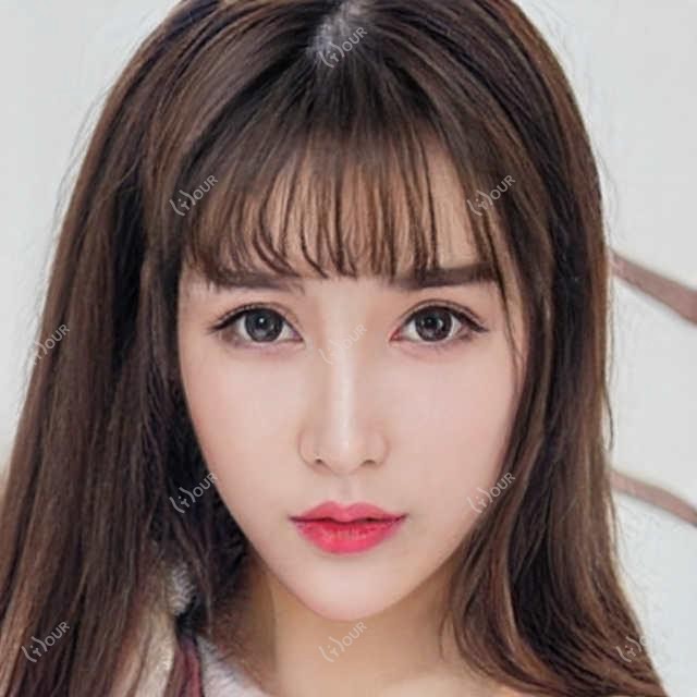 广州健丽美诗沁医美去眼袋多少钱?内切3K-6K/外切4K-8K/激光溶脂2K-5K