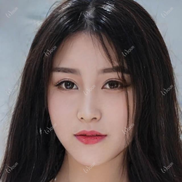 珠海市欣悦医美门诊部价格揭秘？玻尿酸填充5K+ 2K+ 激光祛斑3K+