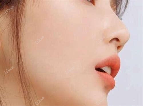 洛阳名医眼部整形排行榜,精选眼部美化医生推荐