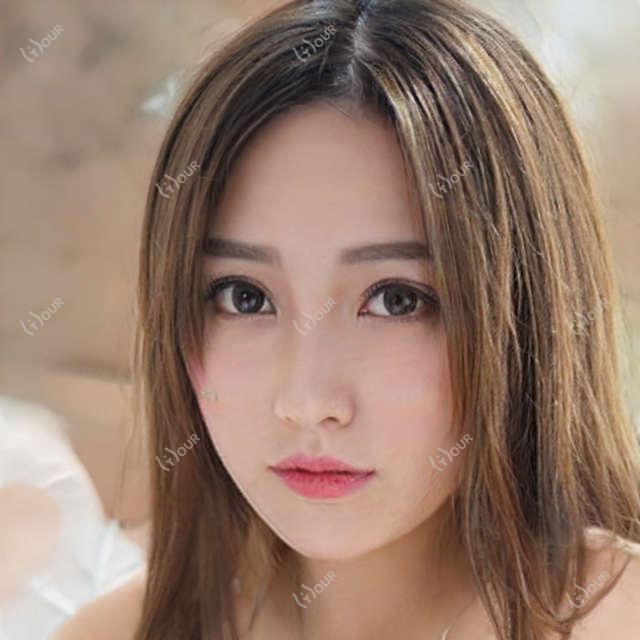 天津南开首爱眼科全项目揭秘:近视激光&白内障手术价格一览