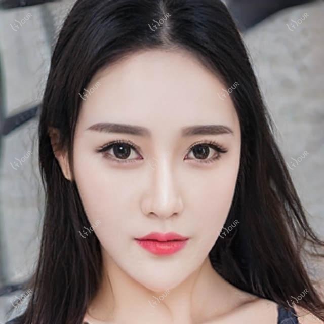 丽水口碑医生推荐：胡靖宇与方剑锋，口腔种植修复技术精细