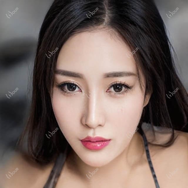 南京丰臀失败修复价格表(收费)-南京丰臀失败修复有性价比是多少