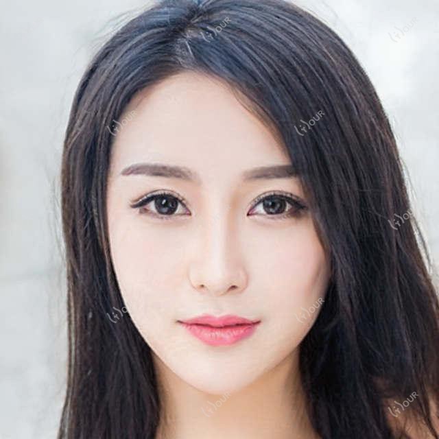 柳州光子嫩肤价目表大公开！附本地靠谱医院推荐，避坑指南看这篇
