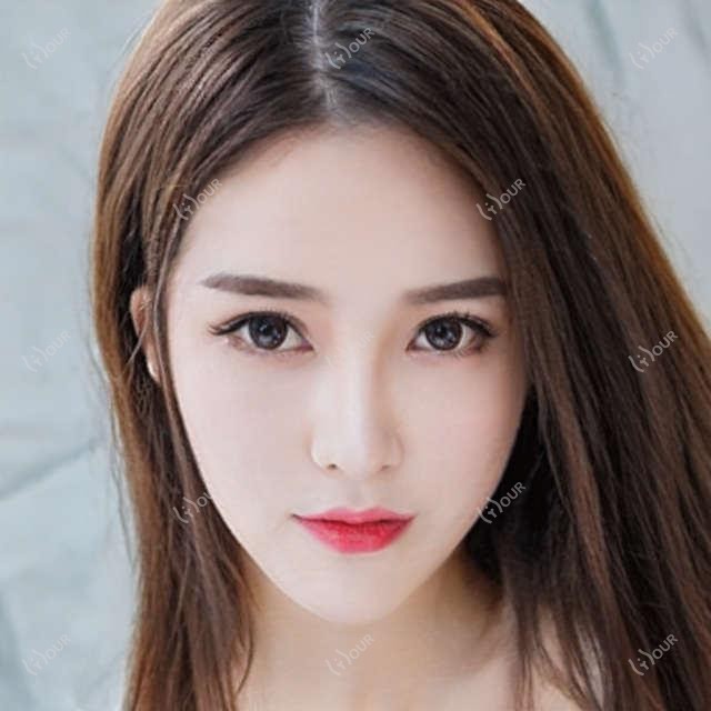 泉州丰额头项目价格对比 玻尿酸填充额头医院排名与伊美网咨询指南