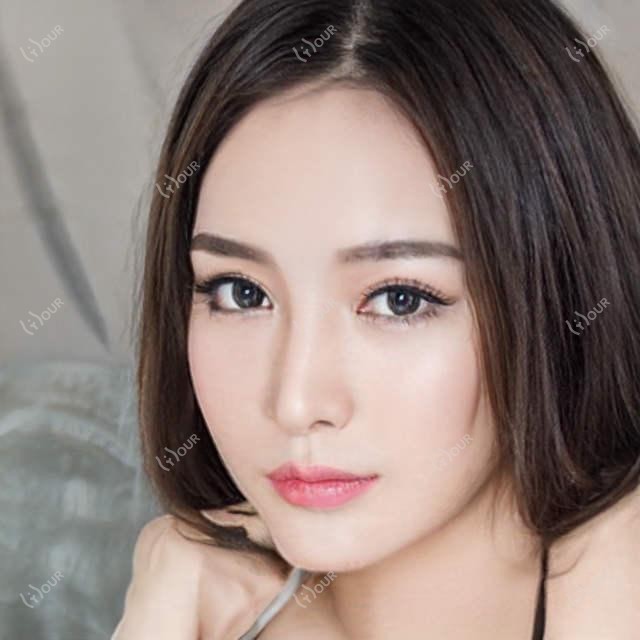 南宁整友力荐近视手术与整形医生榜,范光忠王龙朱格非等名医参考
