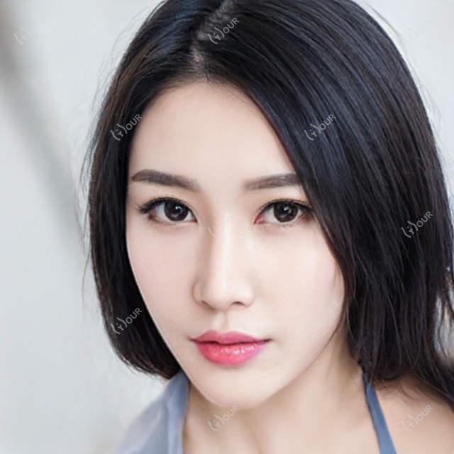 武汉媄妲医美全项目价格揭秘:埋线微整至种植牙,详尽价格表一览无遗