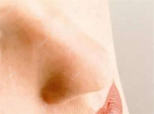 成都隐形眼镜贵不贵?海昌隐形眼镜60元左右