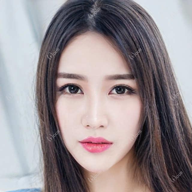 武汉何氏眼科项目价格全览：近视手术+白内障治疗详细报价公布