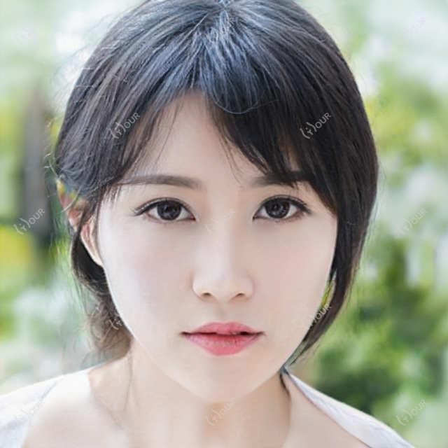信阳地区眼部鼻部胸部整形名医何黎技术精细受推崇