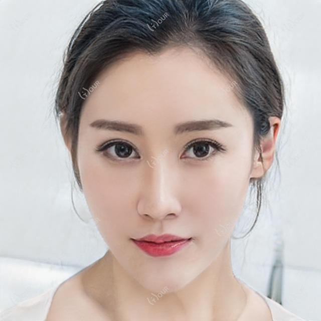 桂林地区面部美容整形医生推荐！甘学文、童亚林、邵家松技术精细，口碑优良