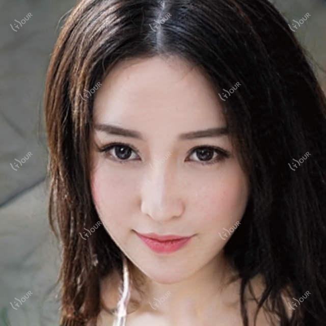 宜昌市乐加口腔整牙费用揭秘：牙齿矫正2W+ 牙齿美白3K+ 种植牙1W+