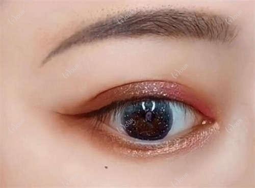 信阳地区眼鼻胸整形名医推荐榜(含特色技术+费用详情)_信阳整形必看
