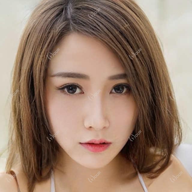 大理丰面颊选胶原蛋白填充还是自体脂肪?1.2万和2.8万项目怎么挑?